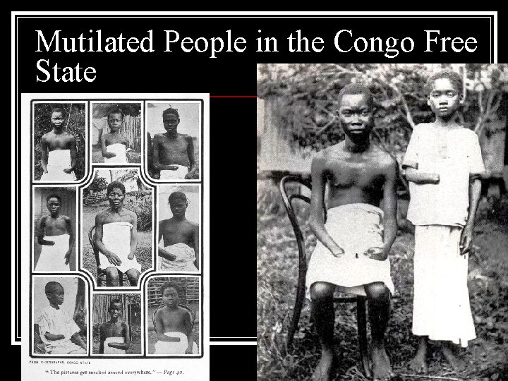 Mutilated People in the Congo Free State 
