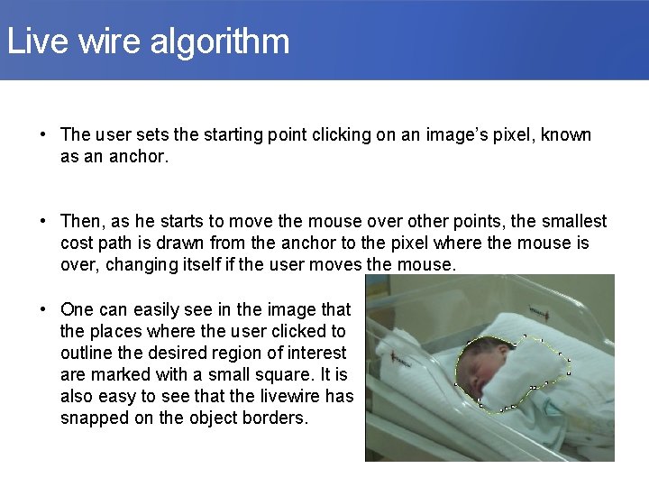 Live wire algorithm • The user sets the starting point clicking on an image’s