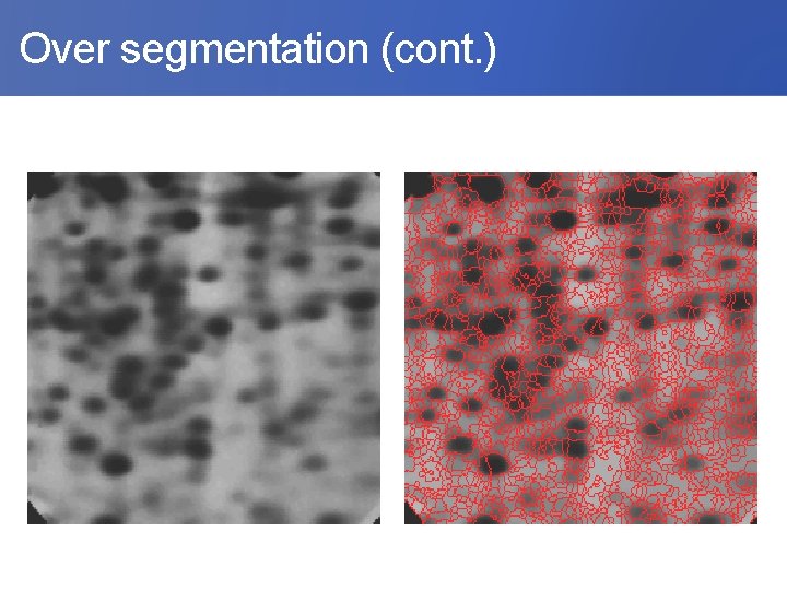  Over segmentation (cont. ) 