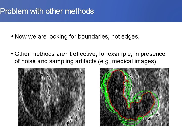 Problem with other methods • Now we are looking for boundaries, not edges. •