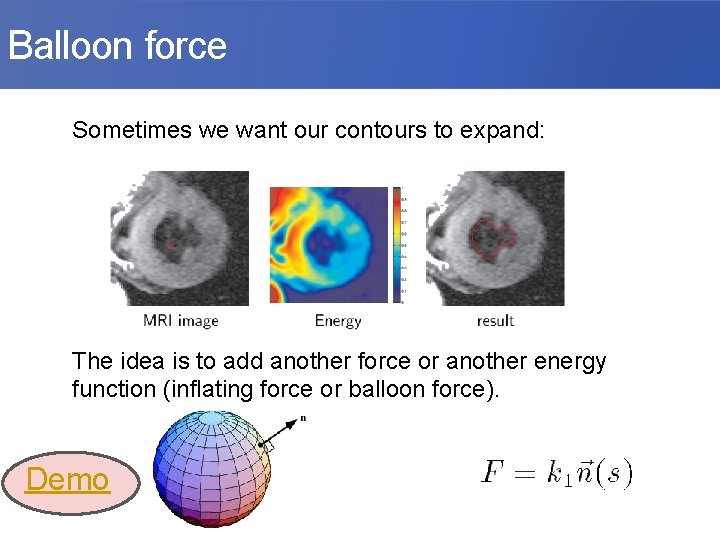 Balloon force Sometimes we want our contours to expand: The idea is to add