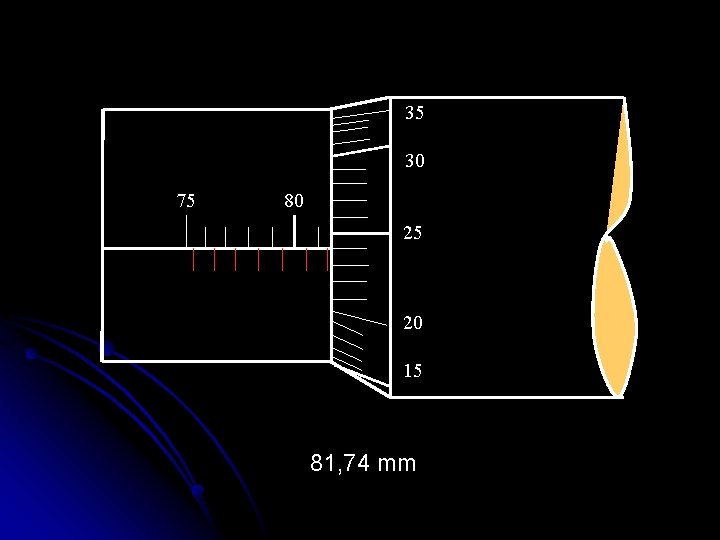 35 30 75 80 25 20 15 81, 74 mm 