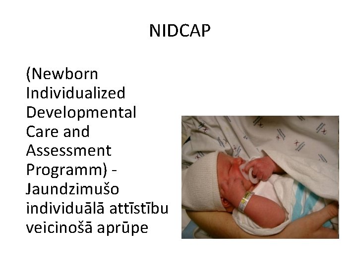 NIDCAP (Newborn Individualized Developmental Care and Assessment Programm) Jaundzimušo individuālā attīstību veicinošā aprūpe 