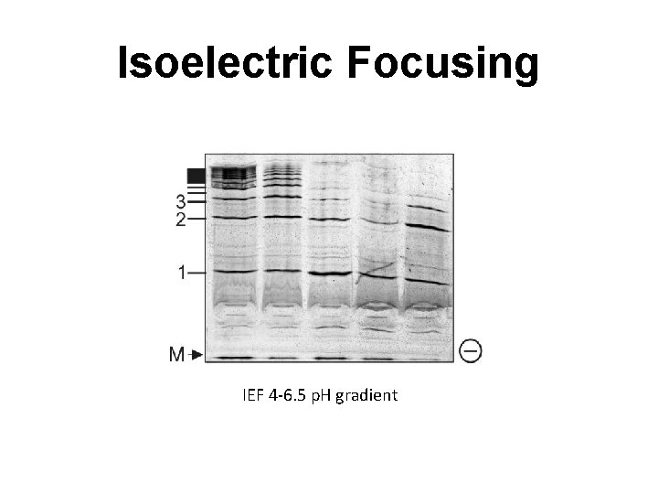 Isoelectric Focusing IEF 4 -6. 5 p. H gradient 