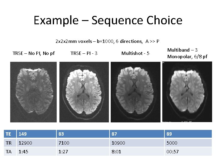 Example – Sequence Choice 2 x 2 x 2 mm voxels – b=1000, 6