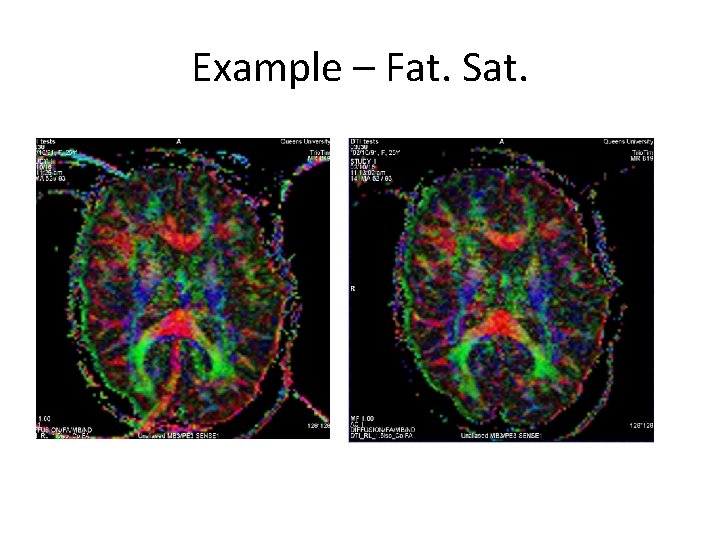 Example – Fat. Sat. 