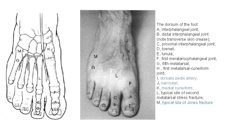 The dorsum of the foot. A, interphalangeal joint; B, distal interphalangeal joint (note transverse
