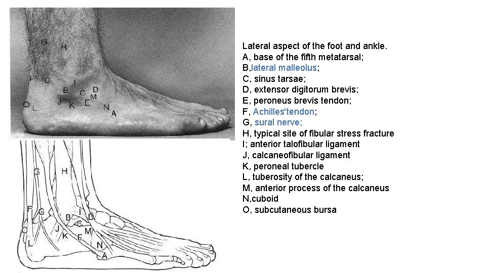 Lateral aspect of the foot and ankle. A, base of the fifth metatarsal; B,