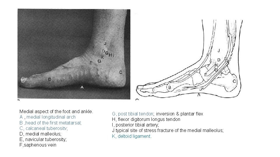 Medial aspect of the foot and ankle. A , medial longitudinal arch B ,