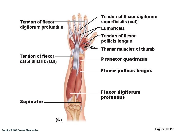 Tendon of flexor digitorum profundus Tendon of flexor digitorum superficialis (cut) Lumbricals Tendon of