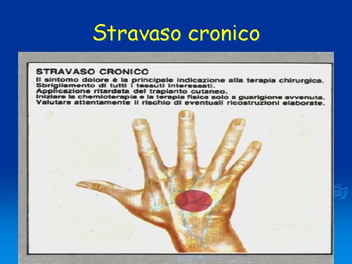 Stravaso cronico 