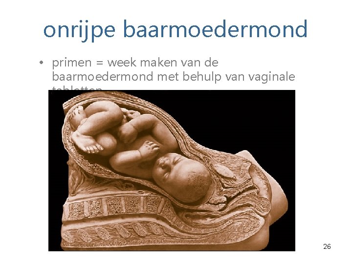 onrijpe baarmoedermond • primen = week maken van de baarmoedermond met behulp van vaginale