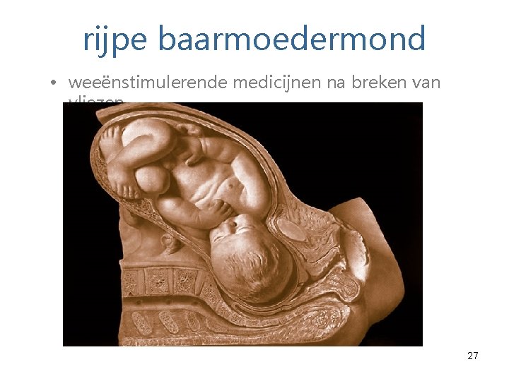 rijpe baarmoedermond • weeënstimulerende medicijnen na breken van vliezen 27 