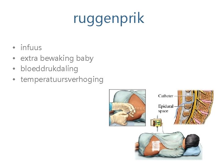 ruggenprik • • infuus extra bewaking baby bloeddrukdaling temperatuursverhoging 32 