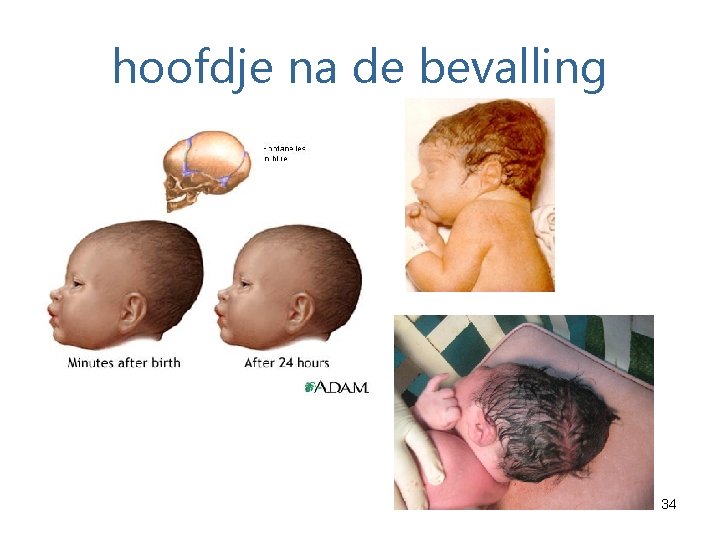 hoofdje na de bevalling 34 