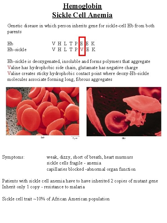 Hemoglobin Sickle Cell Anemia Genetic disease in which person inherits gene for sickle-cell Hb Hemoglobin Sickle Cell Anemia Genetic disease in which person inherits gene for sickle-cell Hb