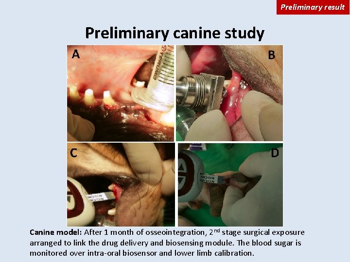Preliminary result Preliminary canine study Canine model: After 1 month of osseointegration, 2 nd