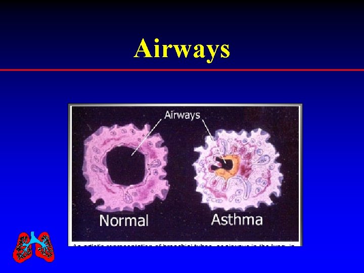 Airways 