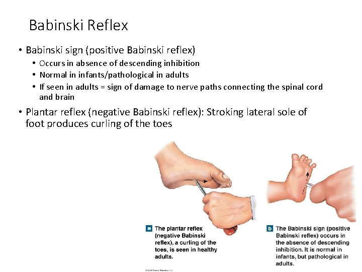 Babinski Reflex • Babinski sign (positive Babinski reflex) • Occurs in absence of descending Babinski Reflex • Babinski sign (positive Babinski reflex) • Occurs in absence of descending
