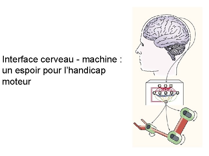 Interface cerveau - machine : un espoir pour l’handicap moteur 