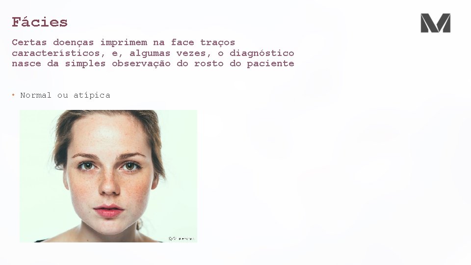 Fácies Certas doenças imprimem na face traços característicos, e, algumas vezes, o diagnóstico nasce