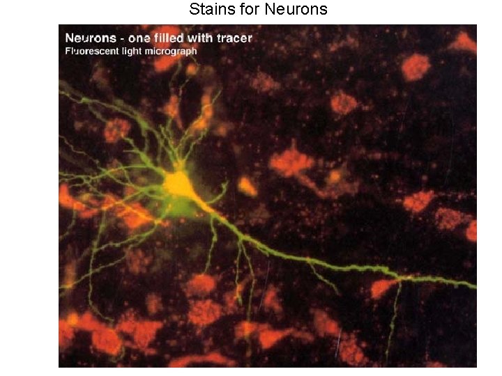 Stains for Neurons 