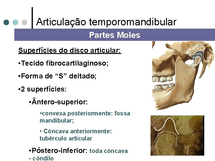 Articulação temporomandibular Partes Moles Superfícies do disco articular: • Tecido fibrocartilaginoso; • Forma de