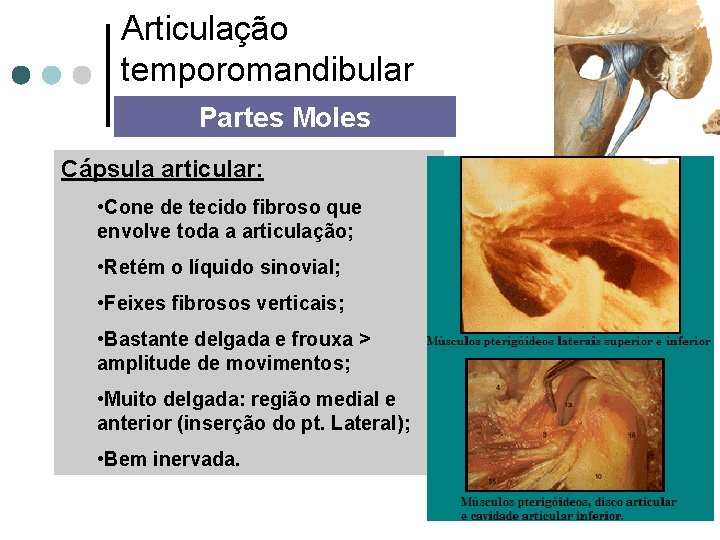 Articulação temporomandibular Partes Moles Cápsula articular: • Cone de tecido fibroso que envolve toda