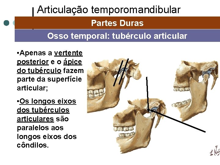 Articulação temporomandibular Partes Duras Osso temporal: tubérculo articular • Apenas a vertente posterior e