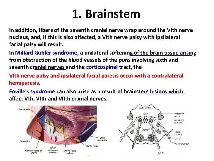 1. Brainstem In addition, fibers of the seventh cranial nerve wrap around the VIth