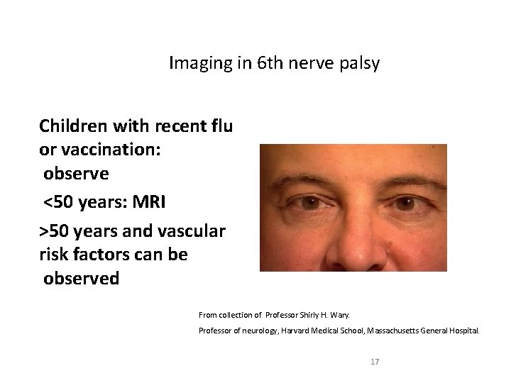 Imaging in 6 th nerve palsy Children with recent flu or vaccination: observe <50