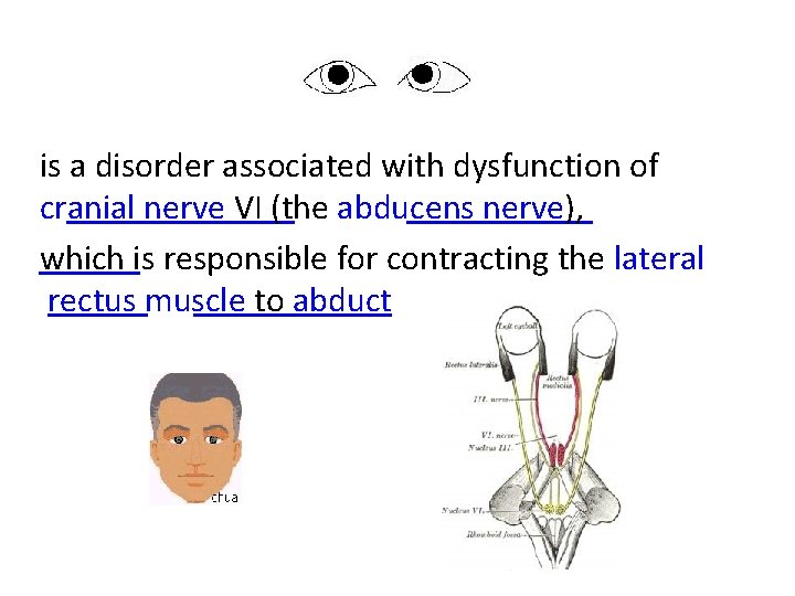 is a disorder associated with dysfunction of cranial nerve VI (the abducens nerve), which