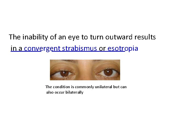 The inability of an eye to turn outward results in a convergent strabismus or