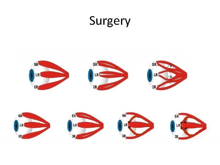 Surgery 