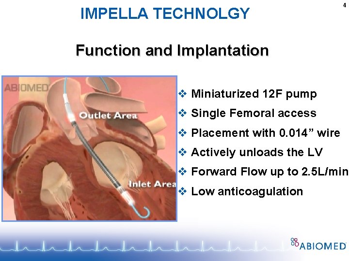IMPELLA TECHNOLGY 4 Function and Implantation v Miniaturized 12 F pump v Single Femoral