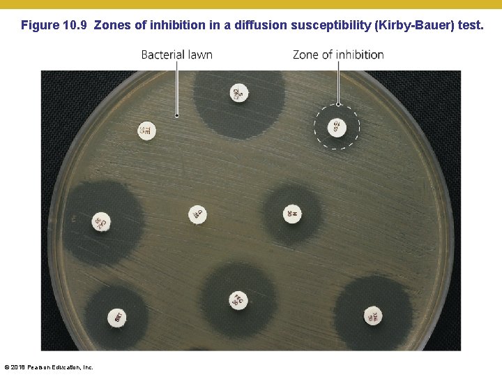 Figure 10. 9 Zones of inhibition in a diffusion susceptibility (Kirby-Bauer) test. © 2018