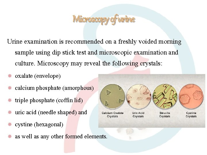 Microscopy of urine Urine examination is recommended on a freshly voided morning sample using