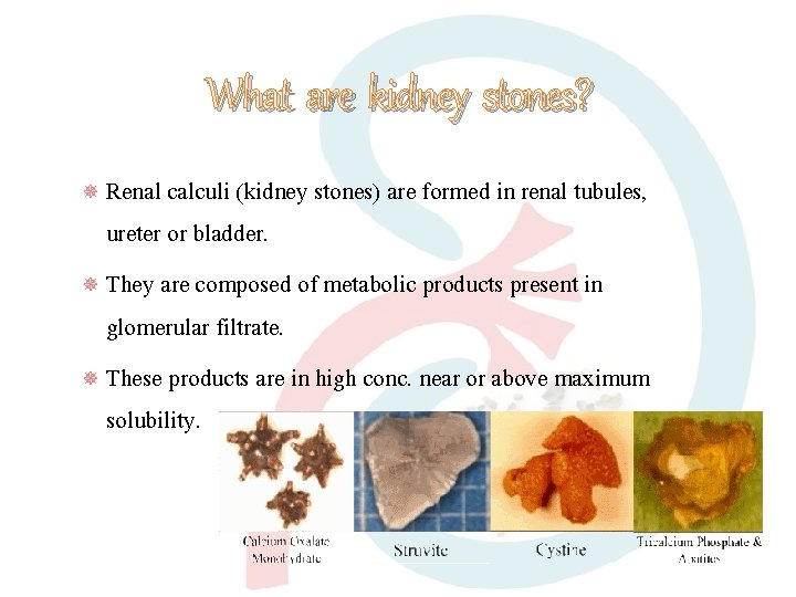 What are kidney stones? Renal calculi (kidney stones) are formed in renal tubules, ureter