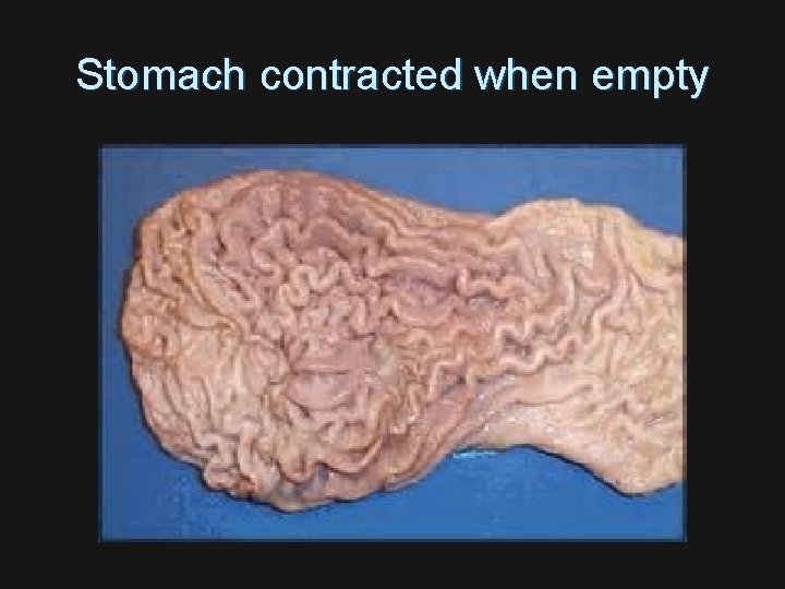 Stomach contracted when empty 