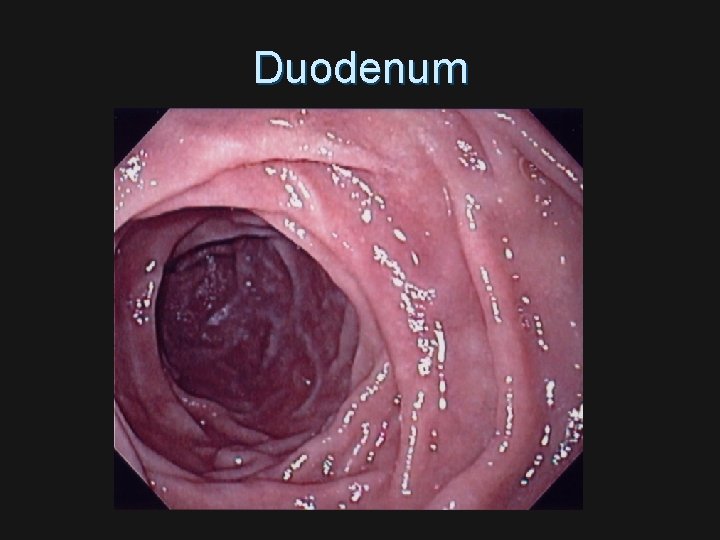 Duodenum 