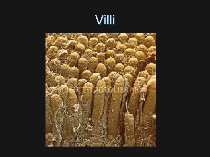 Villi 