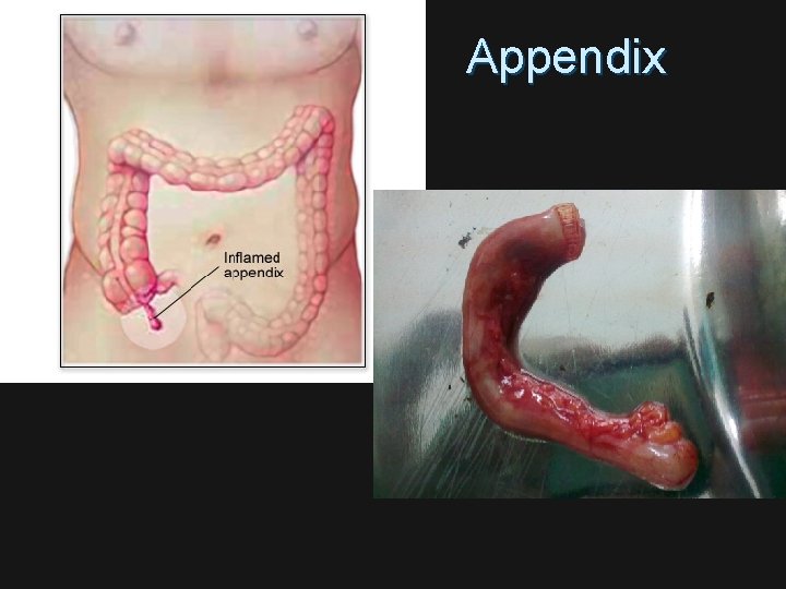 Appendix 