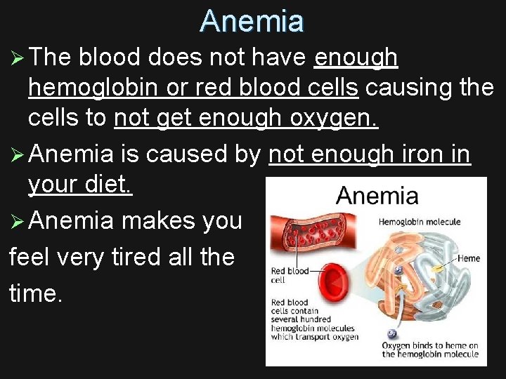 Anemia Ø The blood does not have enough hemoglobin or red blood cells causing