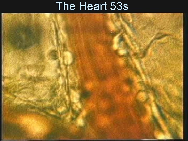 The Heart 53 s 