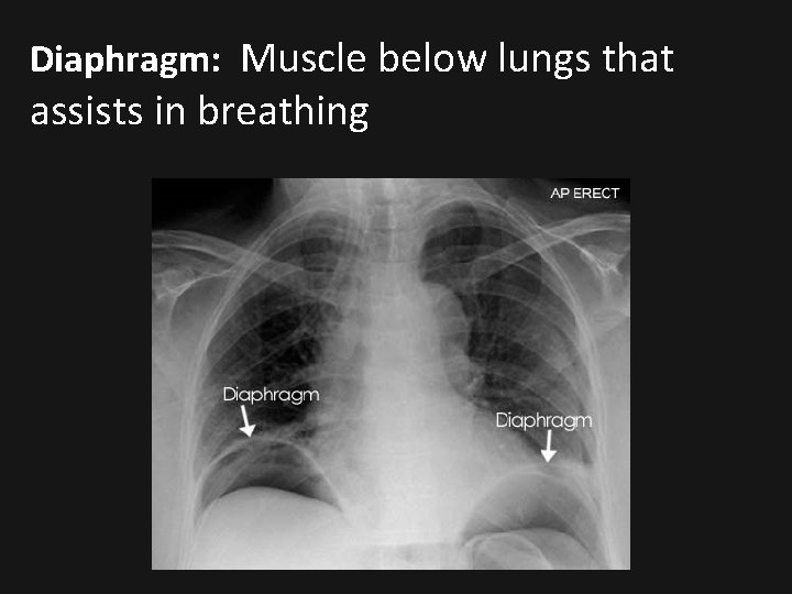 Diaphragm: Muscle below lungs that assists in breathing 