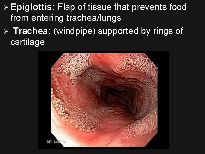 Ø Epiglottis: Flap of tissue that prevents food from entering trachea/lungs Ø Trachea: (windpipe)