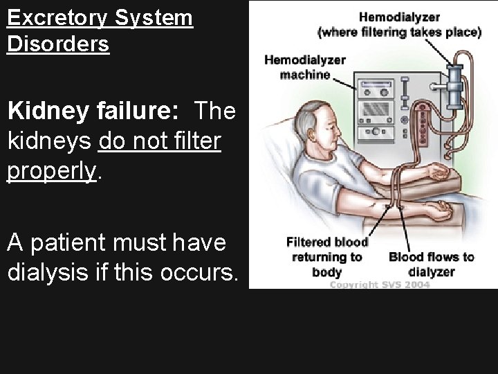 Excretory System Disorders Kidney failure: The kidneys do not filter properly. A patient must
