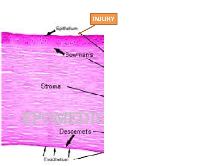 INJURY 