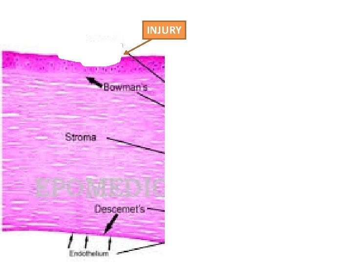 INJURY 
