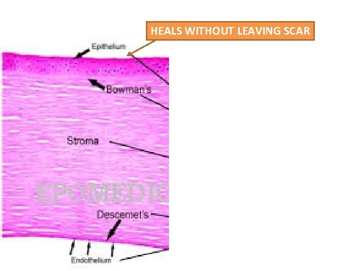 HEALS WITHOUT LEAVING SCAR 